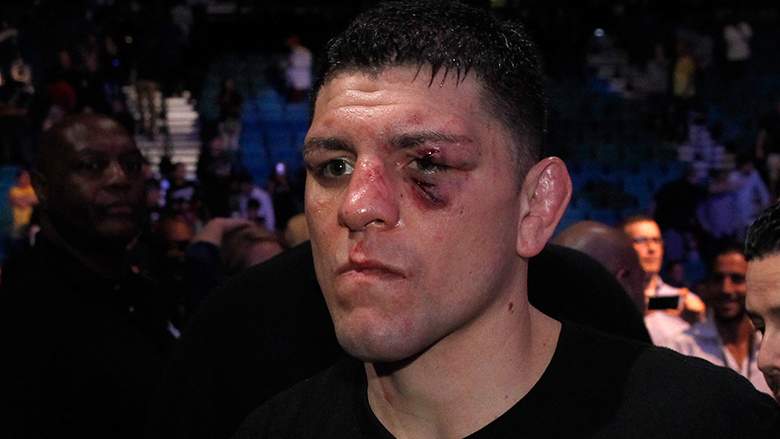 Dana White demonstra otimismo com possível volta de Nick Diaz (Foto: Getty Images)